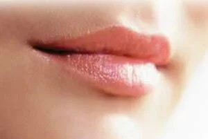 Проблема сухости губ